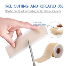 Load image into Gallery viewer, Silicone Scar Tape Roll